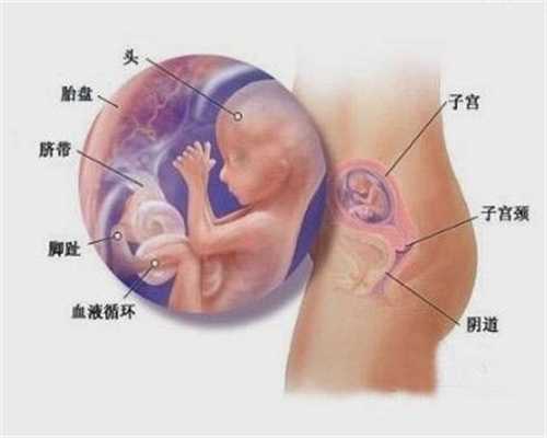 成都有代孕生下孩子的吗_成都人工精子代孕_启辰助孕是真的吗_宝宝出现脐疝怎