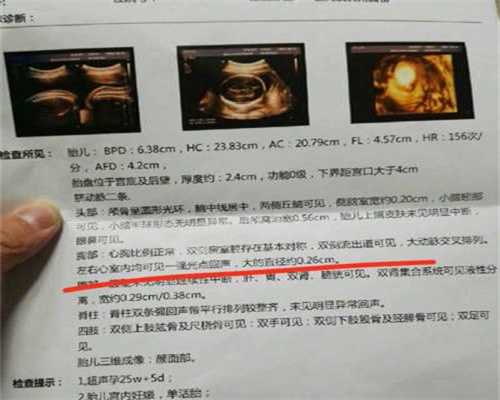 供卵试管婴儿多少钱_成都的供卵私立医院_刚做完流产可以捐卵呢北京三级医院